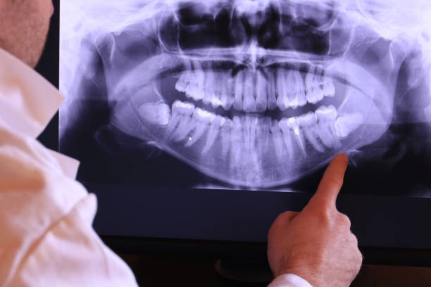 Best Weekend Emergency Dental Services in Blue Ridge, VA